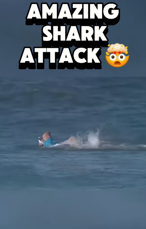 Shark Attack in Australia Leaves Beachgoers Terrified!