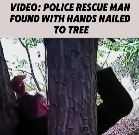 Police Shocked After Rescuing Man Found With His Hands Nailed to a Tree in the Woods
