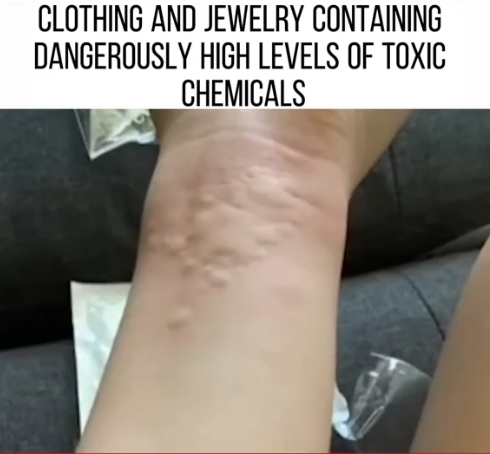Toxic Fashion? Clothing and Jewelry Found to Contain Dangerous Levels of Poisonous Chemicals!