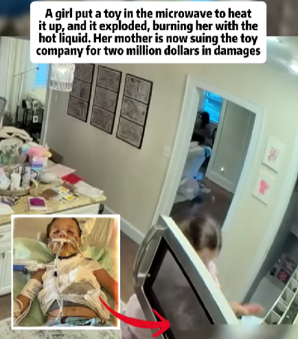 Toy Explodes in Microwave — Young Girl Suffers Severe Burns, Mother Launches $2M Lawsuit Against Manufacturer