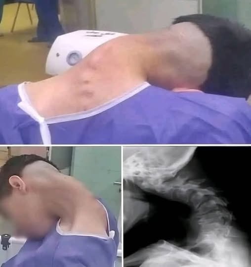 Young man hospitalized because he dropped his ca… See more