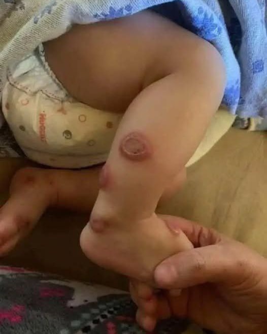 ALERT: These are the