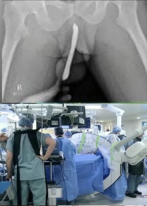 Girl had to be hospitalized for wanting to use a pe…See more