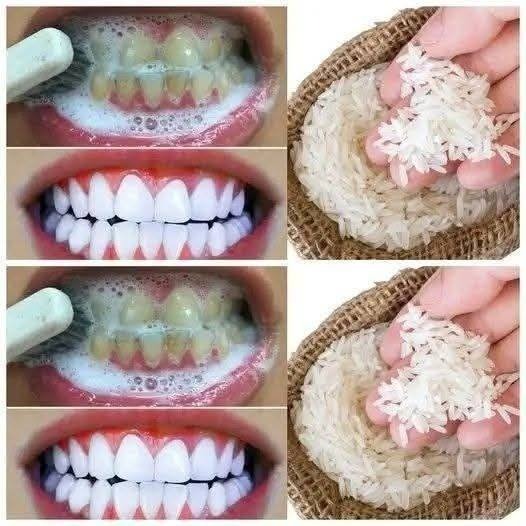  Teeth Whitening Trick with Rice — A Natural, 1-Minute Smile Brightener (Or Cautionary Tale?)