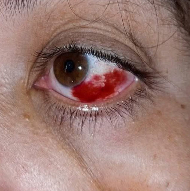 These are the consequences of sleeping with…See more