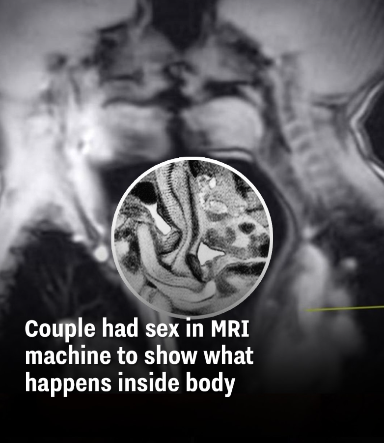 Couple had sex in MRI machine to show what happens inside body