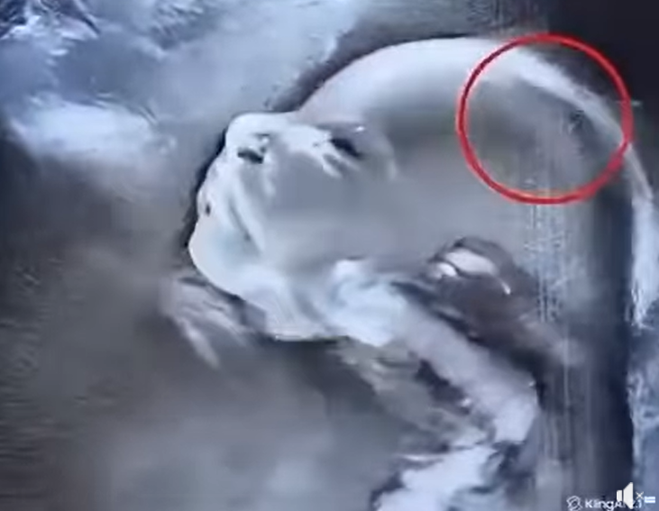 Doctors Were Left Speechless by What They Saw in the Ultrasound