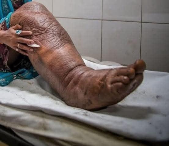 HT2. These are the consequences of sleeping with a… See more