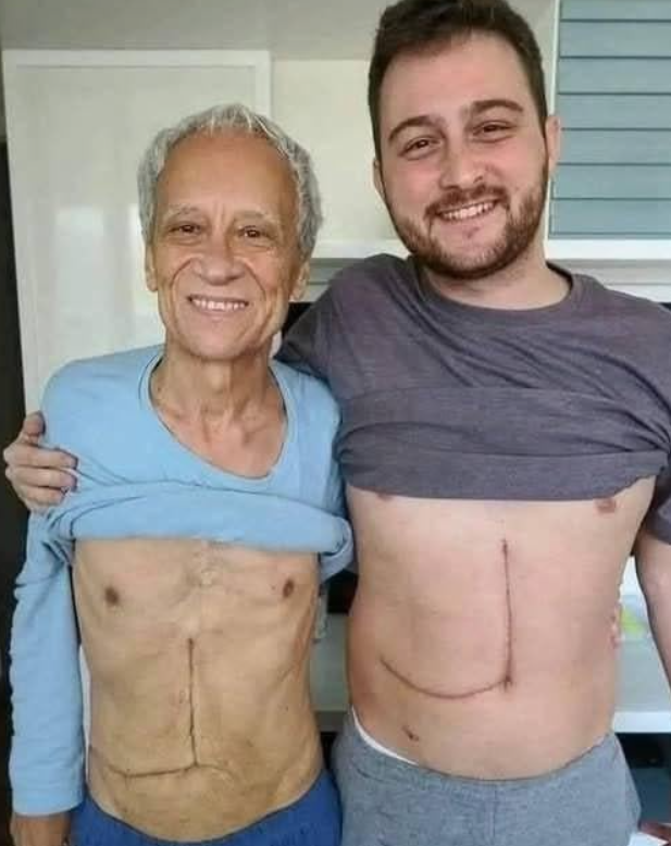Son who donated part of his liver to his father unfortunately ends up fa