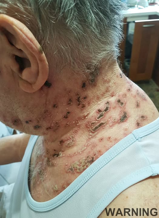 This is the silent disease that is triggered when you come into contact