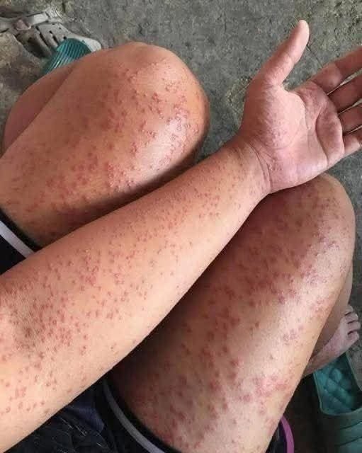 These are the consequences of sleeping