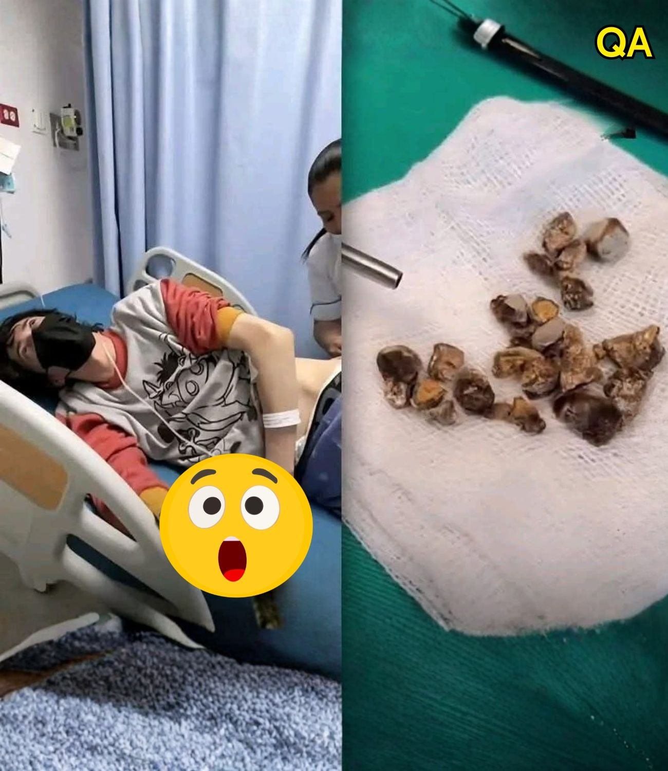 Man hospitalized after allowing himself to be penetrated