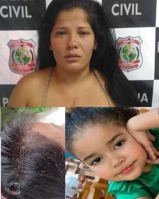 3-year-old girl d!es after lice attack and mother